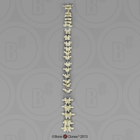 Human Female Asian Vertebral Column-all 24 Vertebrae, Disarticulated