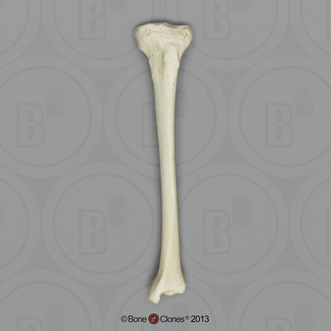 Human Female Asian Tibia