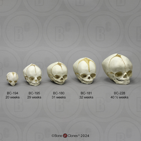 Human Fetal Skull Set of 5 Skulls