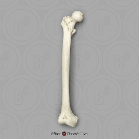 Human Adult Male Femur, African