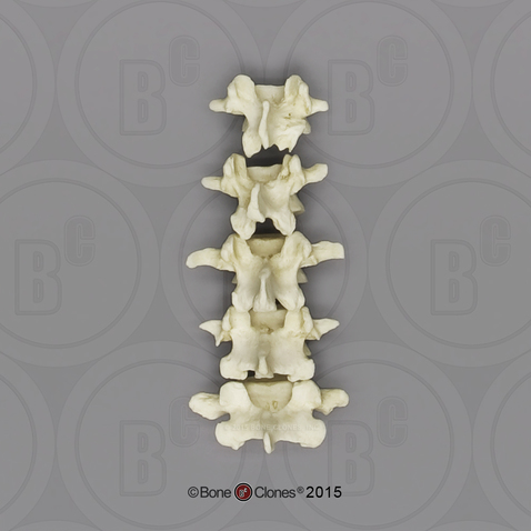 Human Female European Lumbar Vertebrae, set of 5