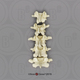 Human Female European Lumbar Vertebrae, set of 5