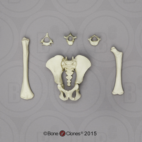 Fetal Orangutan C-2, T-4, L-4, Humerus, Femur, Pelvis, Sacrum and Coccyx