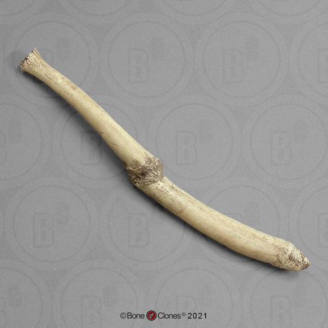 Walrus Baculum, Pathological