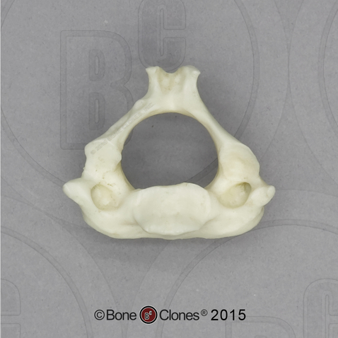 Human European American Male 13-year-old C-2 Vertebra