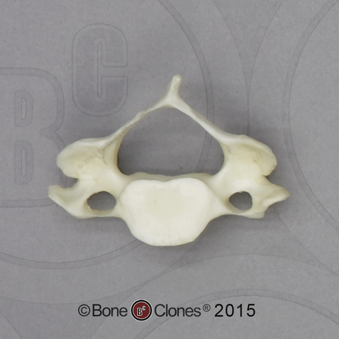 Human European American Male 13-year-old C-5 Vertebra