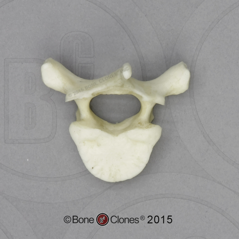 Human European American Male 13-year-old T-5 Vertebra