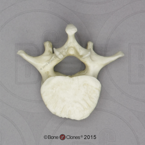 Human European American Male 13-year-old L-3 Vertebra