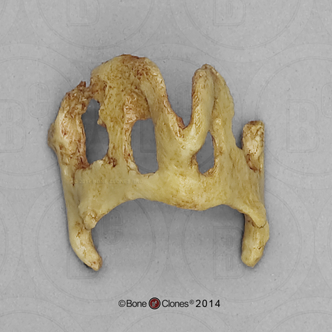 Human 68-year-old Male Ossified Thyroid