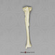 Healed Left Tibia Fracture