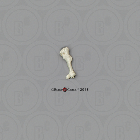 Human Female Achondroplasia Dwarf Humerus