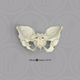 Human Female Achondroplasia Dwarf Pelvis, Articulated