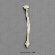 Human Female Achondroplasia Dwarf Right Fibula