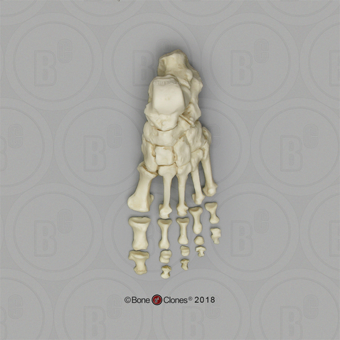 Human Female Achondroplasia Dwarf Foot, Semi-articulated