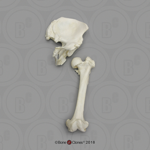 Human Female Achondroplasia Dwarf Innominate and Femur Set