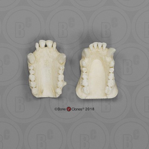 Sumatran Orangutan Maxilla and Mandible