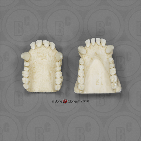 Male Chimpanzee Maxilla and Mandible