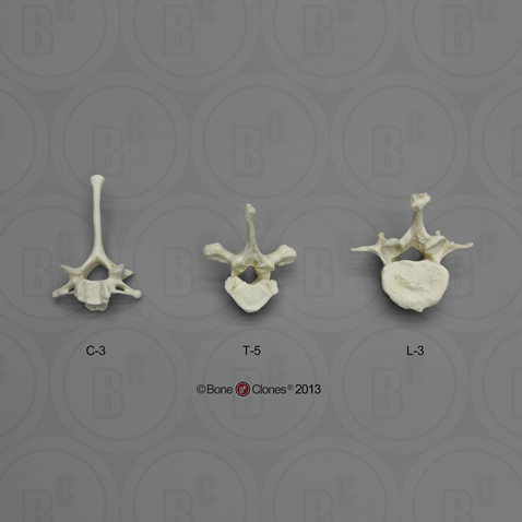 Gorilla Vertebrae, Set of 3 - Cervical, Thoracic, Lumbar