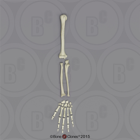 Human Male European Arm, Disarticulated w/ Disarticulated Hand (no Scapula)