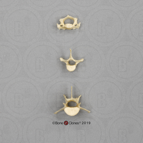 Aye-aye Vertebrae, Set of 3 - Cervical, Thoracic, Lumbar