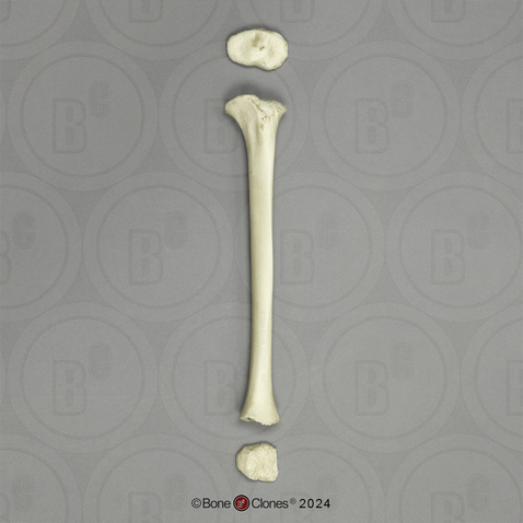 Human Child 6-year-old Tibia