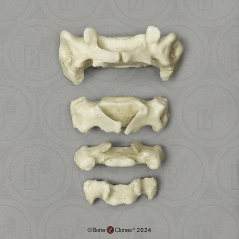 Human Child 6-year-old Sacrum