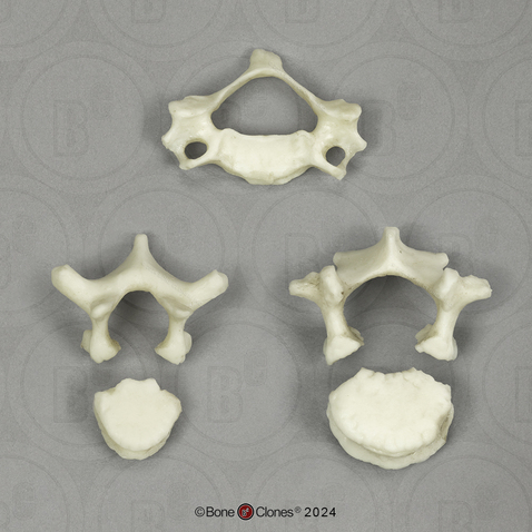 Human Child 6-year-old Vertebrae, Set of 3 - Cervical, Thoracic, Lumbar