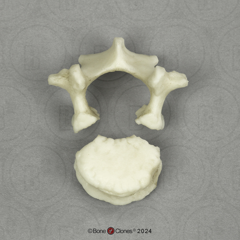 Human Child 6-year-old Lumbar Vertebra, Single