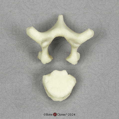 Human Child 6-year-old Thoracic Vertebra, Single