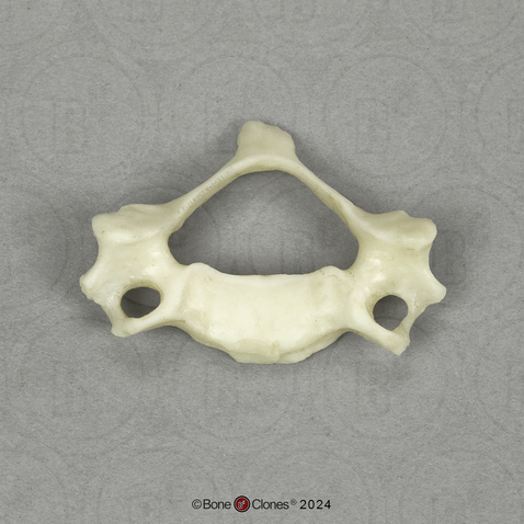 Human Child 6-year-old Cervical Vertebra, Single