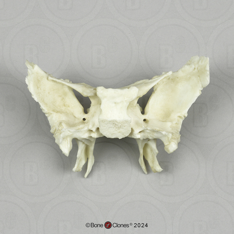 Human Sphenoid