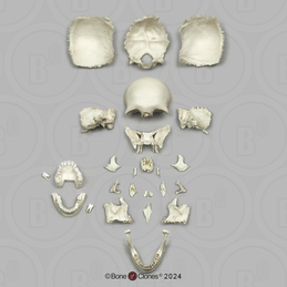 Human Medical Study Skull, Disarticulated