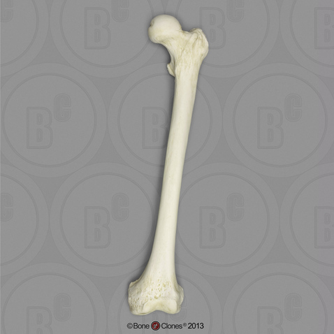 Human Male Asian Robust Femur