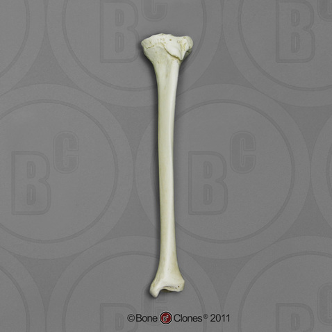 Human Adolescent Tibia