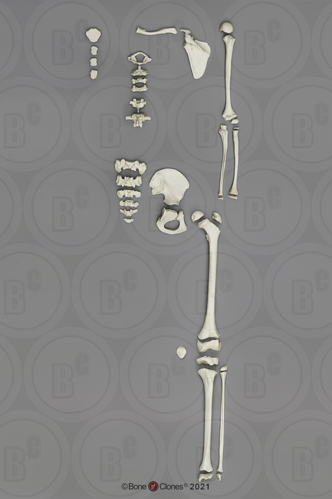 Human European American Male 13-year-old Partial Skeleton