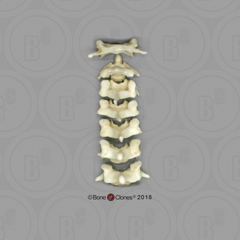 Male Chimpanzee Cervical Vertebrae, set of 7