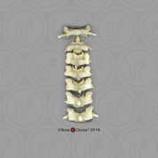 Male Chimpanzee Cervical Vertebrae, set of 7