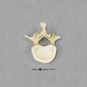 Human Male Asian Lumbar Vertebra, Single