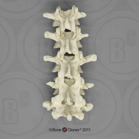 Human Male Asian Lumbar Vertebrae, Set of 5