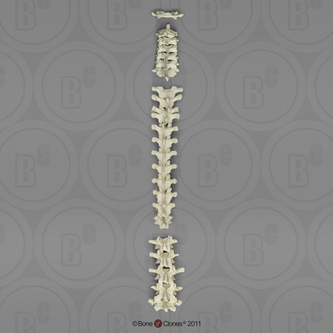 Human Male Asian Vertebral Column-all 24 Vertebrae, Disarticulated