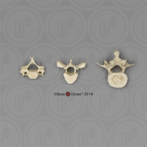 Human Female European Vertebrae, set of 3 - Cervical, Thoracic, Lumbar