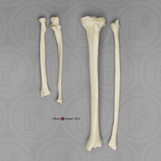 Comparative Set, Radius, Ulna, Tibia, Fibula, Adult Female European