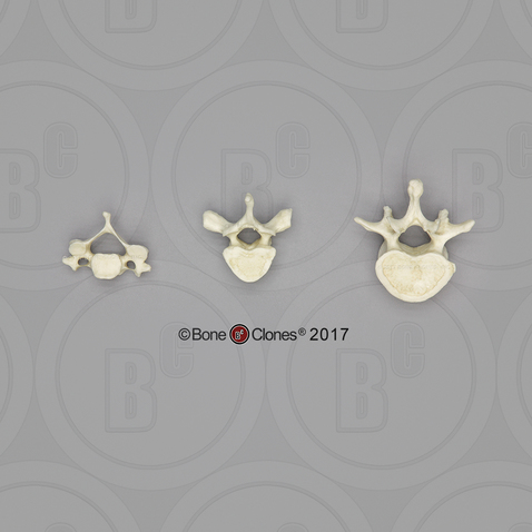 Human Male European Vertebrae, set of 3 - Cervical, Thoracic, Lumbar