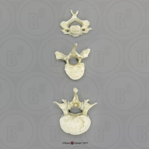 Human Male Asian Robust Vertebrae, Set of 3 - Cervical, Thoracic, Lumbar