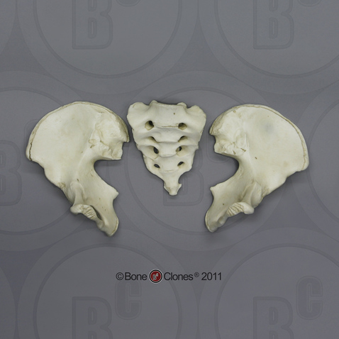 Human Adolescent Pelvis, Disarticulated