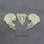 Human Adolescent Pelvis, Disarticulated