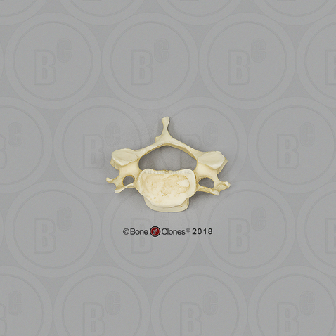 Human Male Asian Cervical Vertebra, Single