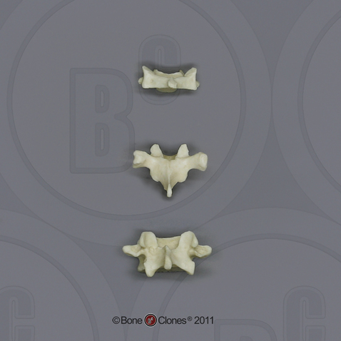 Human Adolescent Vertebrae, Set of 3 - Cervical, Thoracic, Lumbar