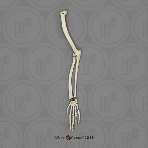 Vervet Arm, Articulated w/ Articulated Rigid Hand (no Scapula)