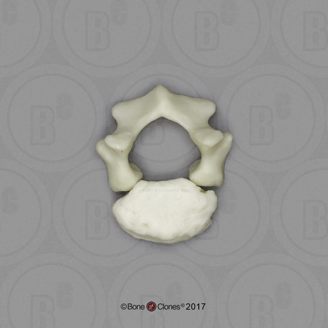 Human Child Lumbar Vertebra, Single (2 pcs.), 14 to 16-month-old